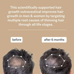 Hair Growth Nutraceutical Haelf