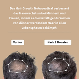 Haarwachstums-Nahrungsergänzungsmittel